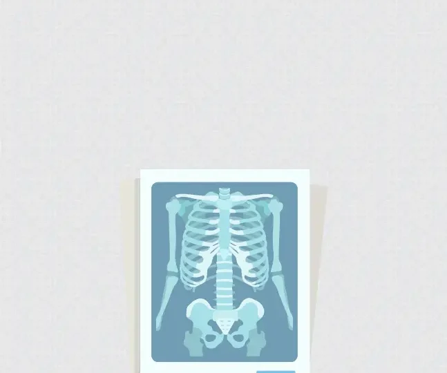 Scoliosis and Chiropractic (1)