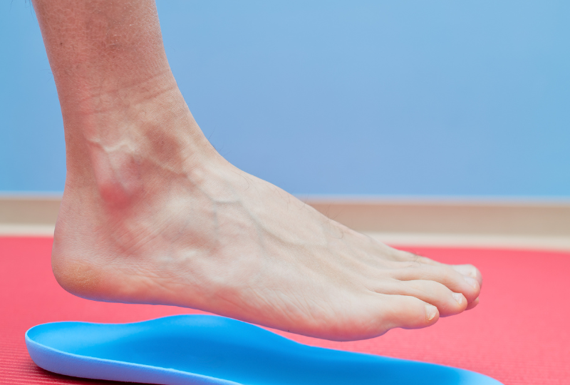 A Guide to Custom Foot Orthotics CURAVITA Health Group Ottawa ByWard Market Glebe Chiropractic Physiotherapy Massage Therapy
