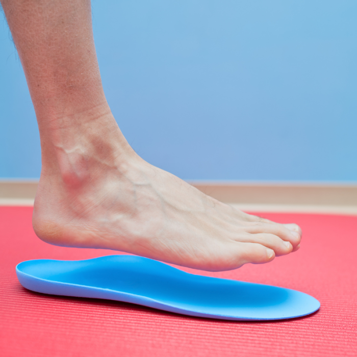 A Guide to Custom Foot Orthotics