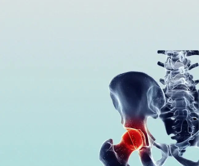 A Pain in the Back Could Mean a Problem in the Hip