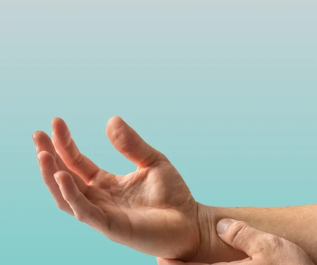 Carpal Tunnel Syndrome