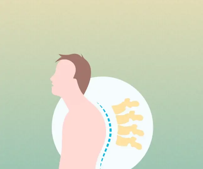 Back Pain Myths
