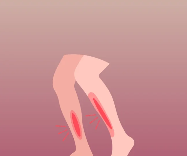 What are Shin Splints (2)