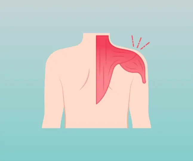 Massage Therapy for Postural Strain and tension. Ottawa massage therapy