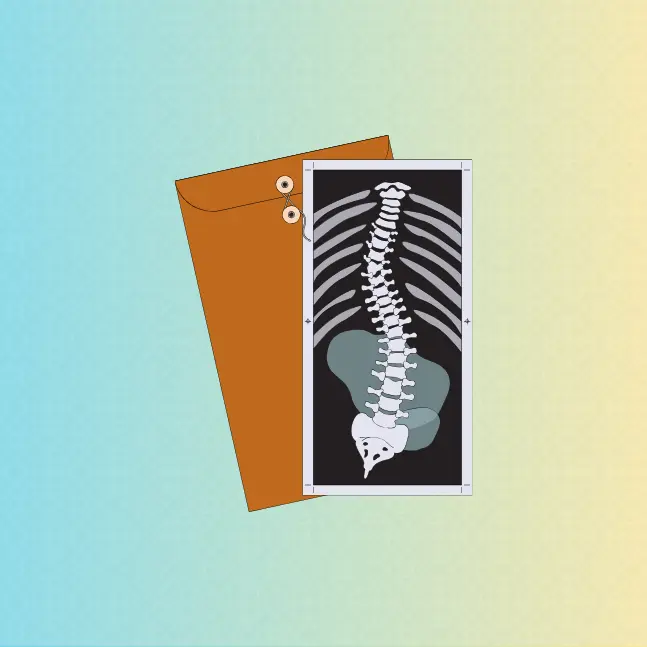 Scoliosis Strategies with Physiotherapy: A Multifaceted Approach