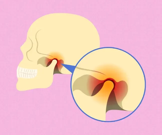 Ottawa Physiotherapy How it Can Help Manage TMJ Disorders