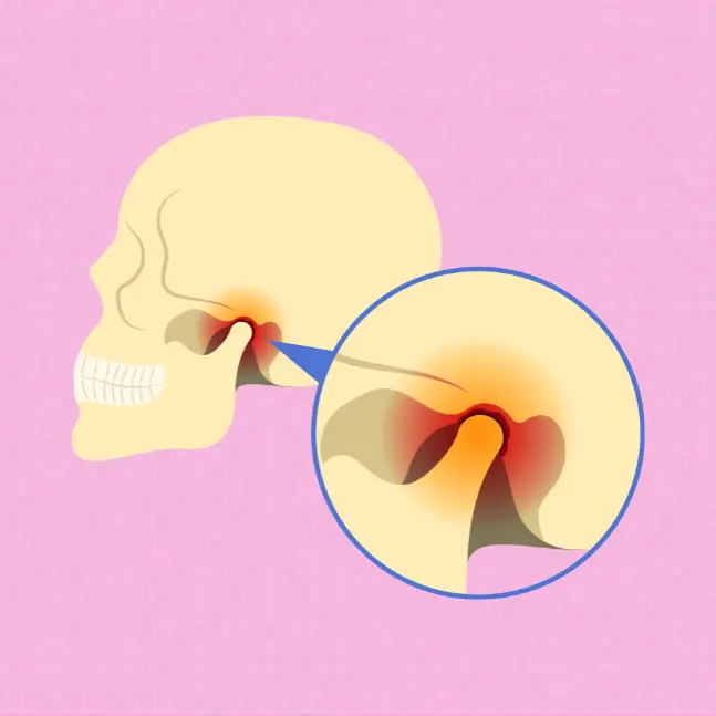 Ottawa Physiotherapy How it Can Help Manage TMJ Disorders