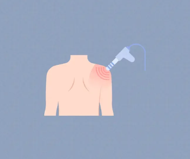 Shockwave Therapy in Physiotherapy How It Works, What to Expect, and When It’s Right for You (1) (Demo)