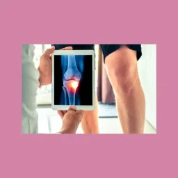 Chiropractic care Ottawa for knee osteoarthritis